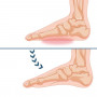 Ortopedické vložky do topánok korigujúce pozdĺžnu plochú nohu, L (40-43)