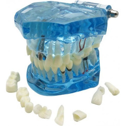Model zubů, zubní implantáty, modrý
