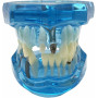 Model chrupu, zubných implantátov, modrý