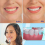 Ultrazvukový čistič zubov Sonic denta pic 3000 s LED svetlom - čistenie a bielenie